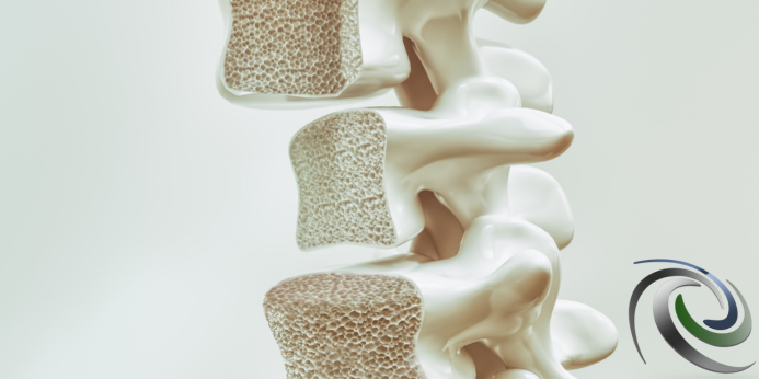 عوامل زمینه‌ ساز پوکی استخوان چیست؟